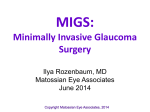 MIGS : Minimally Invasive Glaucoma Surgery