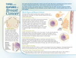 Types of Breast Cancer Brochure - HER2 Positive Breast Cancer