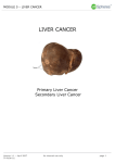 MODULE 5 – LIVER CANCER LIVER CANCER Primary Liver