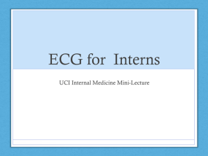 ECG for Interns