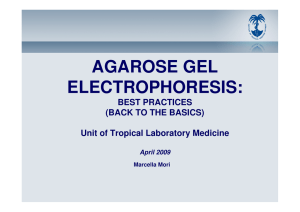 Agarose Gel Electrophoresis: Best Practices