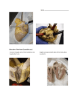 22-Heart Dissection