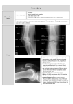 Knee Injury - WordPress.com
