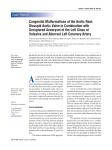 Congenital Malformations of the Aortic Root: Bicuspid Aortic Valve in