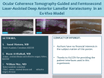 Ocular Coherence Tomography-Guided and Femtosecond Laser