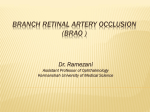 Branch retinal artery occlusion (brao )