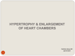 ECG signs of Cardiac hypertrophy and enlargement of heart chambers