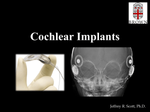 Cochlear Implant - (canvas.brown.edu).