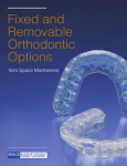 Fixed and Removable Orthodontic Options