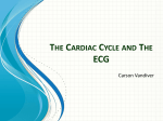 Carson ECG presentation
