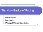 The Very Basic`s of Pacing