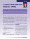 Ocular Surface Squamous Neoplasia (OSSN)