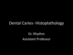 Dental Caries- Histoplathology