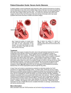 Patient Education Guide: Severe Aortic Stenosis