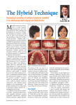 The Hybrid Technique - Kravitz Orthodontics