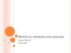 Botox in thyroid eye disease