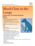 blood_clots_in_the_lungs