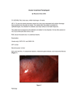 Ocular Cicatricial Pemphigoid