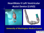 HeartMate II Left Ventricular Assist Device (LVAD)