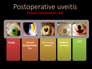 Uveitis