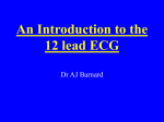 12 Lead ECG Interpretation