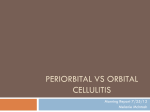 Periorbital vs Orbital Cellulitis