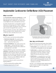 Implantable Cardioverter Defibrillator (ICD)