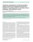 Temporary replacement of missing maxillary lateral incisors with