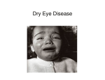 Dry Eye Disease - Sjogrens Society of Canada