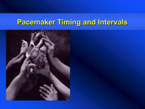 Pacemaker Timing - 123SeminarsOnly.com