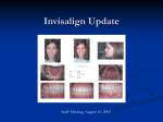 The Five Big Invisalign Questions