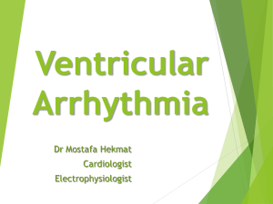 Ventricular Arrhythmia