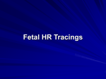 Fetal Tracings - East Bay Newborn Specialists