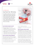 Ischemic Stroke - American Stroke Association
