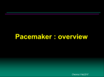pacemaker malfunction