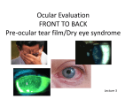 LECTURE 3 tear film pathology_dry eye styndrome