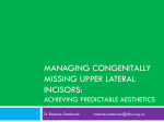 Managing congenitally missing upper lateral incisors