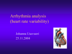 Arrhytmia analysis