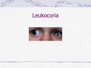 Leukocoria - Diabetic Retinopathy