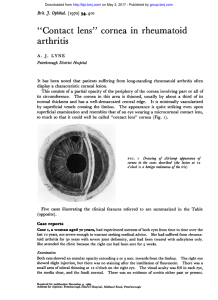 "Contact lens" cornea in rheumatoid arthritis