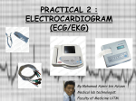 practical 2 : electrocardiogram (ecg/ekg)