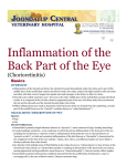 Inflammation of the Back Part of the Eye