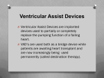 VAD - Ventricular Assist Devices