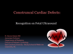 Conotruncal Cardiac Defect