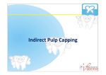 Indirect pulp capping