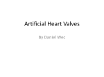 Artificial Heart Valves