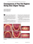 Consequences of Poor oral hygiene During Clear aligner Therapy
