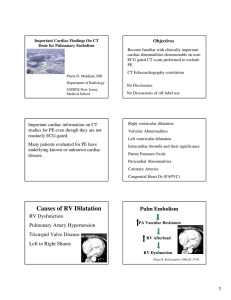 Causes of RV Dilatation