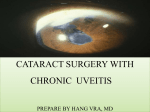 Cataract Surgery in Uveitis