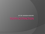 Tooth extraction